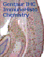 Sections through transgenic Alzheimer mouse brain for histology and immunohistochemistry, unstained
